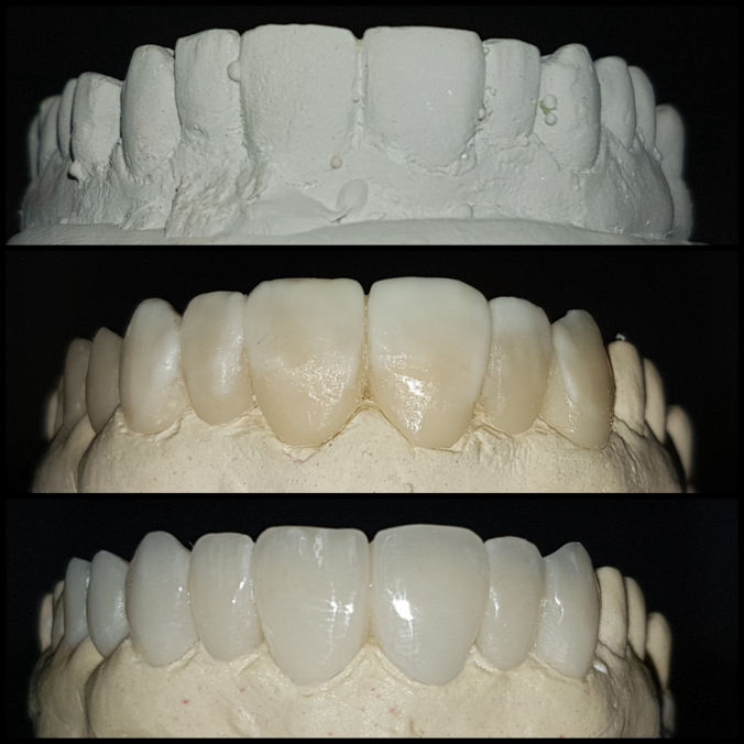 Montedental