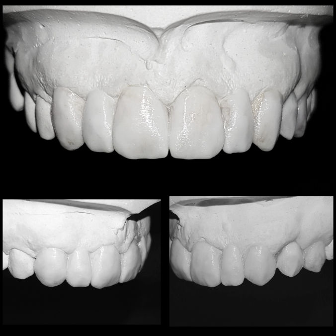 Montedental