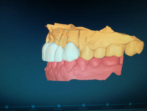 Montedental