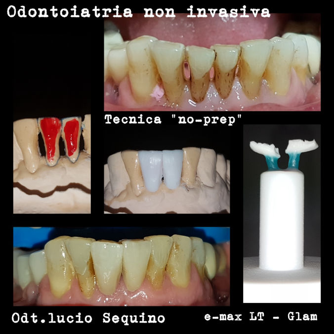 Montedental