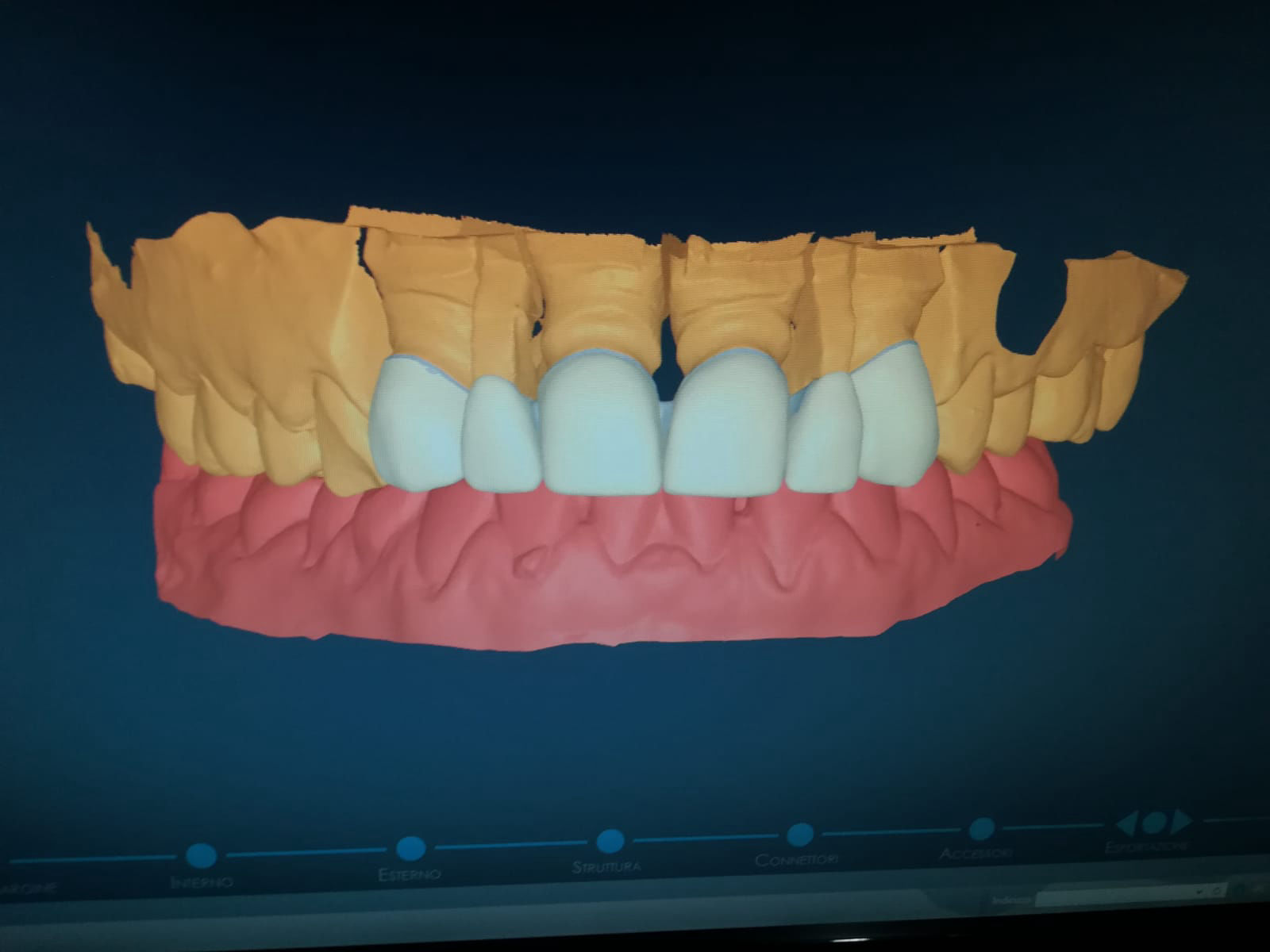 Montedental